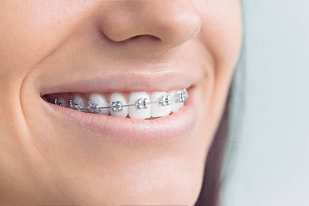 Best Invisalign and Clear Aligners  in Bowie, MD
